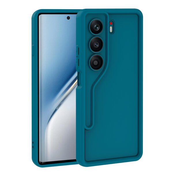 tecno camon 40 4g kilif kamera korumali zore ananas kapak tecno camon 40 4g zore 513553 40 b 1.jpg
