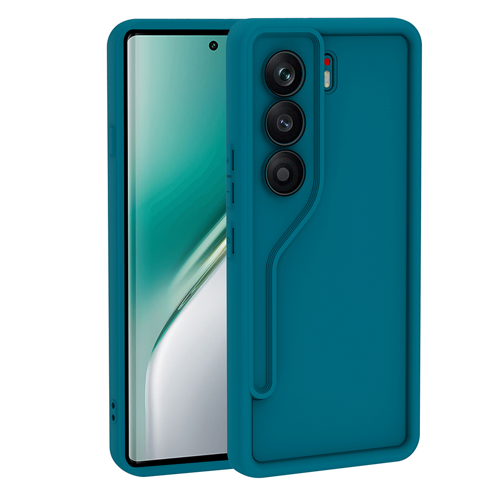 tecno camon 40 pro kilif kamera korumali zore ananas kapak tecno camon 40 pro zore 513560 40 b.jpg