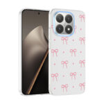 xiaomi 15t kilif kamera korumali desenli zore klip kapak xiaomi 15t zore 533013 42 o.jpg