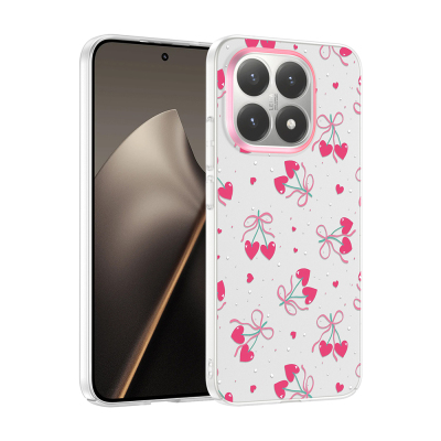 xiaomi 15t kilif kamera korumali desenli zore klip kapak xiaomi 15t zore 533019 42 k.jpg