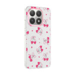 xiaomi 15t kilif kamera korumali desenli zore klip kapak xiaomi 15t zore 533021 42 b.jpg