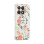 xiaomi 15t kilif kamera korumali desenli zore klip kapak xiaomi 15t zore 533024 42 b.jpg