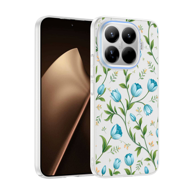 xiaomi 15t pro kilif kamera korumali desenli zore klip kapak xiaomi 15t pro zore 533046 42 k.jpg
