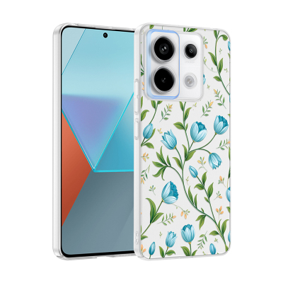 xiaomi redmi note 13 pro 5g kilif kamera korumali desenli zore klip kapak xiaomi redmi note 13 pro 5g zore 532620 42 k.jpg
