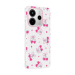 xiaomi redmi note 14 4g kilif kamera korumali desenli zore klip kapak xiaomi redmi note 14 4g zore 532631 42 b.jpg
