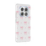 xiaomi redmi note 14 pro 4g kilif kamera korumali desenli zore klip kapak xiaomi redmi note 14 pro 4g zore 532646 42 b.jpg