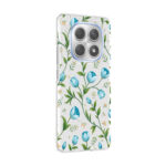 xiaomi redmi note 15 4g kilif kamera korumali desenli zore klip kapak xiaomi redmi note 15 4g zore 532664 42 b.jpg
