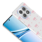 xiaomi redmi note 15 5g kilif kamera korumali desenli zore klip kapak xiaomi redmi note 15 5g zore 532669 42 b.jpg
