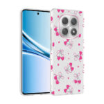 xiaomi redmi note 15 5g kilif kamera korumali desenli zore klip kapak xiaomi redmi note 15 5g zore 532671 42 b.jpg