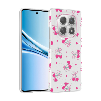 xiaomi redmi note 15 5g kilif kamera korumali desenli zore klip kapak xiaomi redmi note 15 5g zore 532671 42 k.jpg