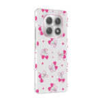 xiaomi redmi note 15 5g kilif kamera korumali desenli zore klip kapak xiaomi redmi note 15 5g zore 532673 42 b.jpg
