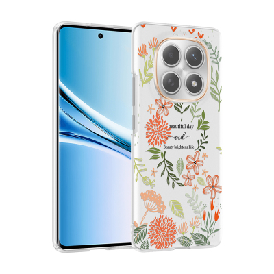 xiaomi redmi note 15 5g kilif kamera korumali desenli zore klip kapak xiaomi redmi note 15 5g zore 532674 42 k.jpg