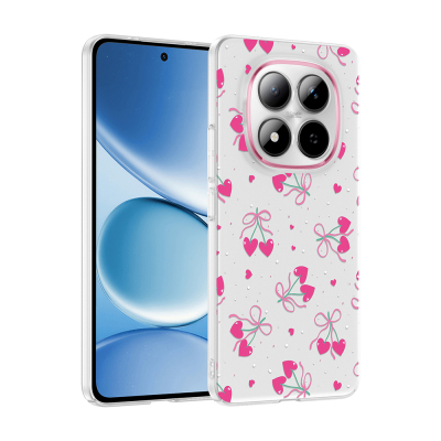 xiaomi redmi note 15 pro 4g kilif kamera korumali desenli zore klip kapak xiaomi redmi note 15 pro 4g zore 532695 42 k.jpg