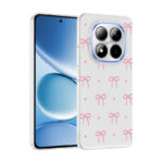 xiaomi redmi note 15 pro plus kilif kamera korumali desenli zore klip kapak xiaomi redmi note 15 pro plus zore 532713 42 o.jpg