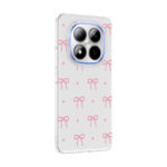xiaomi redmi note 15 pro plus kilif kamera korumali desenli zore klip kapak xiaomi redmi note 15 pro plus zore 532715 42 b.jpg