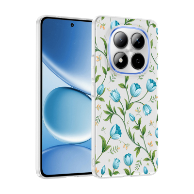 xiaomi redmi note 15 pro plus kilif kamera korumali desenli zore klip kapak xiaomi redmi note 15 pro plus zore 532716 42 k.jpg