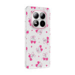 xiaomi redmi note 15 pro plus kilif kamera korumali desenli zore klip kapak xiaomi redmi note 15 pro plus zore 532721 42 b.jpg