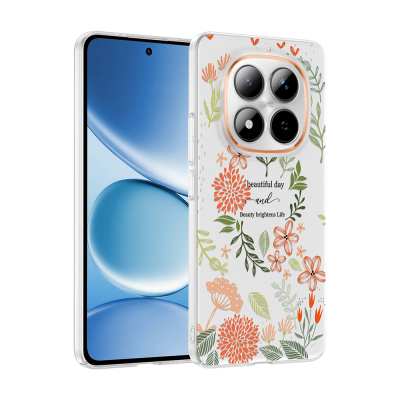 xiaomi redmi note 15 pro plus kilif kamera korumali desenli zore klip kapak xiaomi redmi note 15 pro plus zore 532722 42 k.jpg