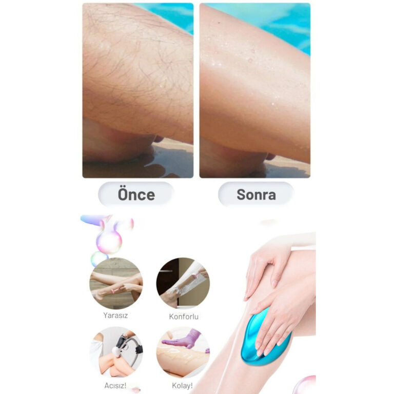 epilator kristal tuy alma ep 102713 2.jpg